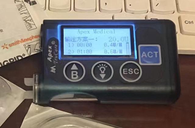 智凯胰岛素泵操作视频